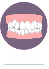 ガタガタ歯