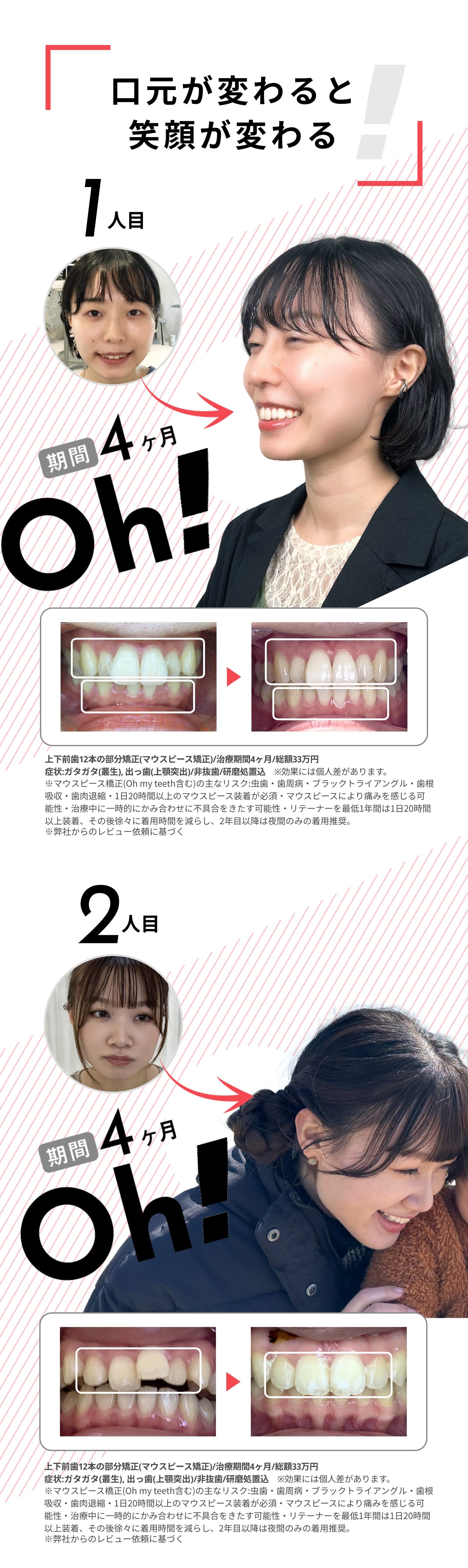 口元が変わると笑顔が変わる!症例ビフォーアフター