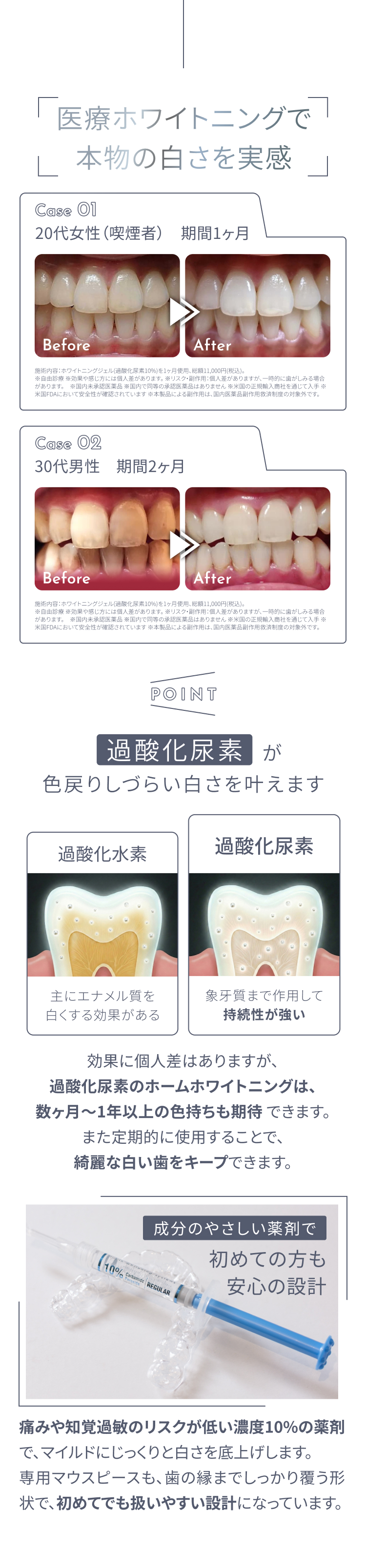 医療ホワイトニングで本物の白さを実感