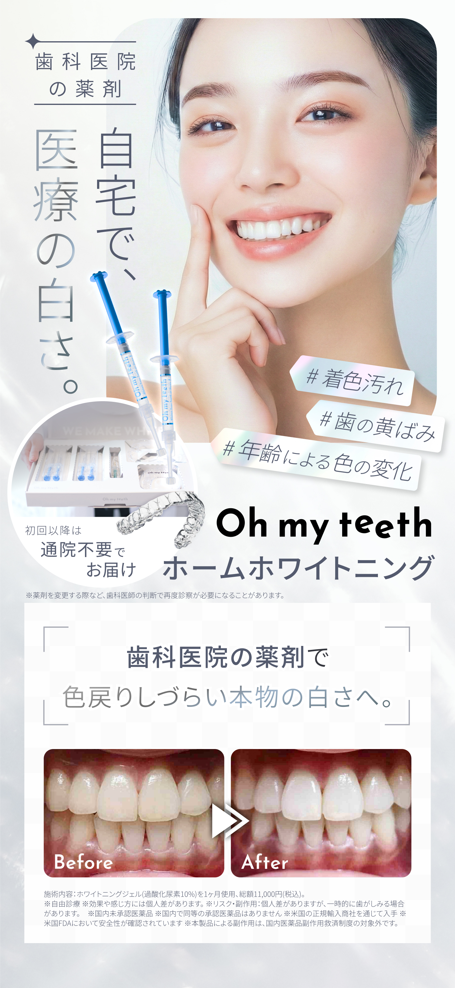 ホームホワイトニング