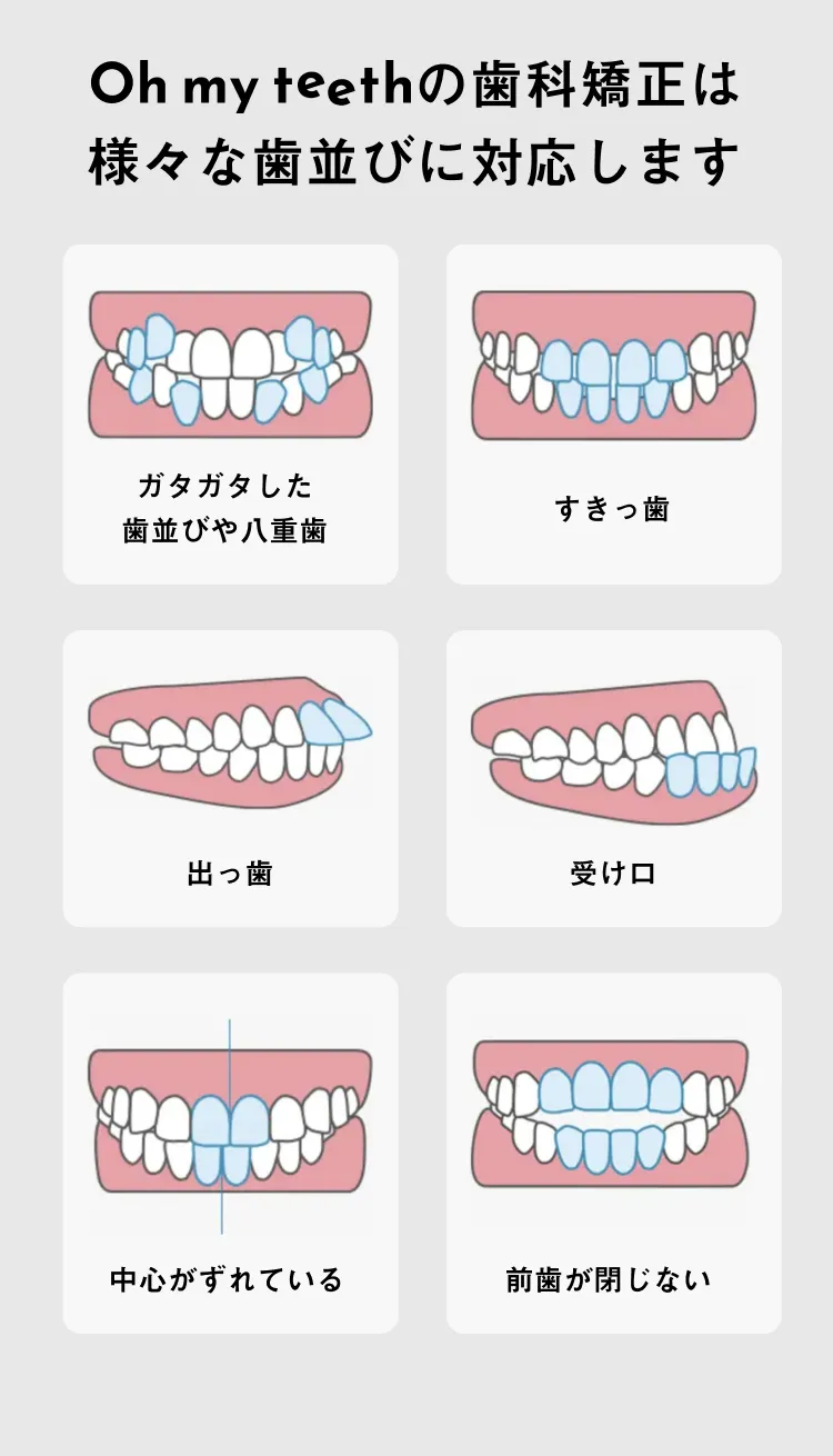 様々な歯並びに対応します