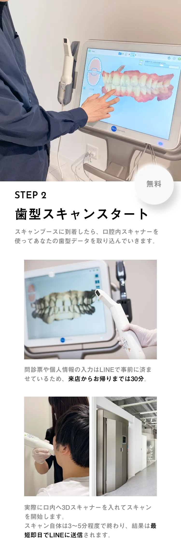 歯型を取る