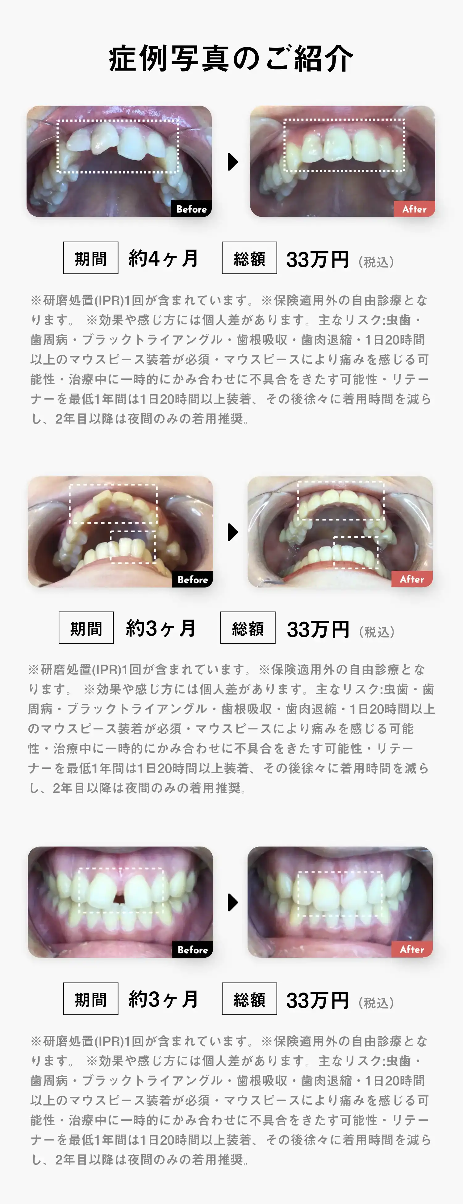 症例のご紹介