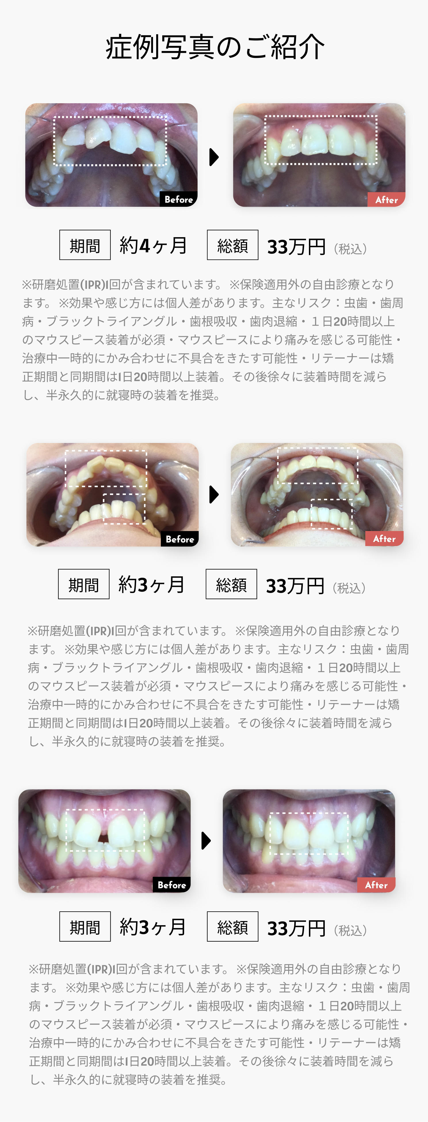 モニター募集のお知らせ