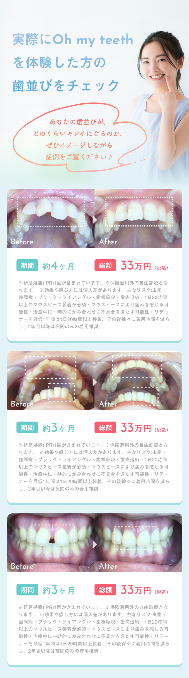 実際に体験した方の歯並びチェック