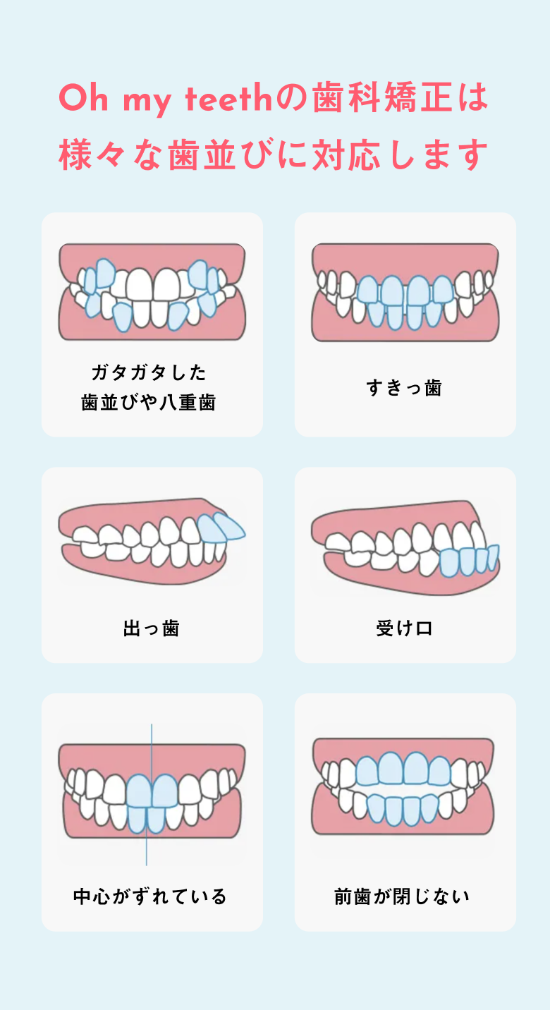 様々な歯並びに対応します