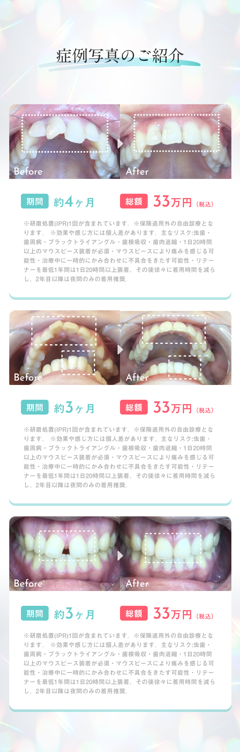 症例のご紹介