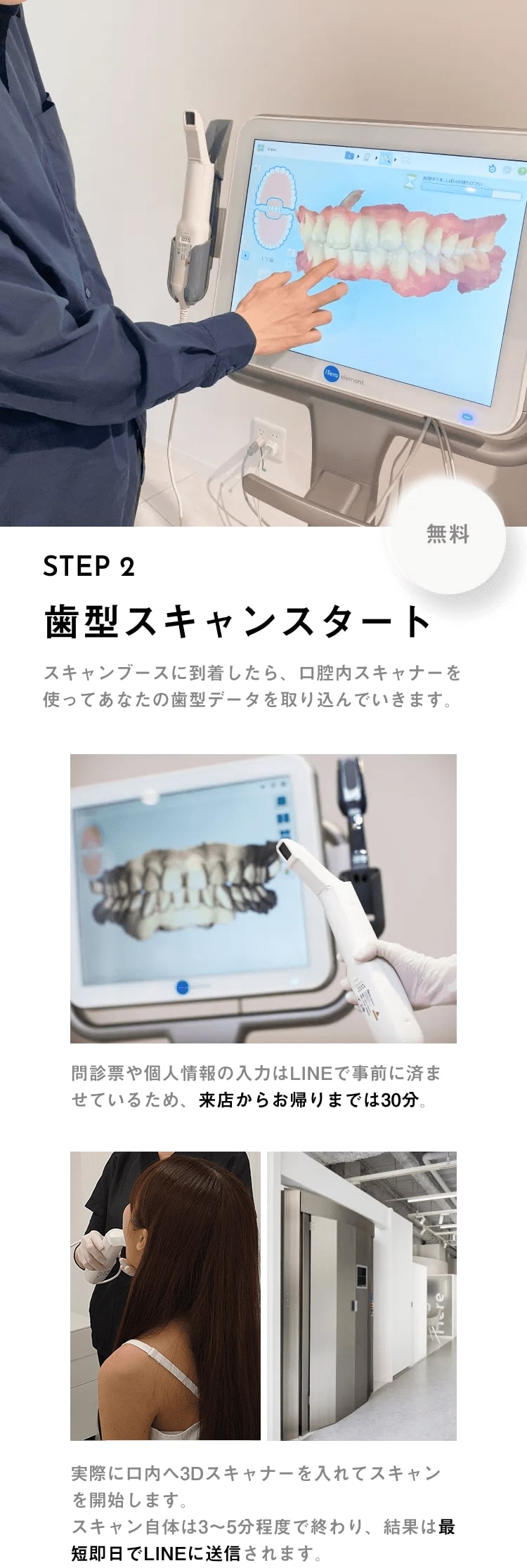 STEP2歯型スキャンスタート