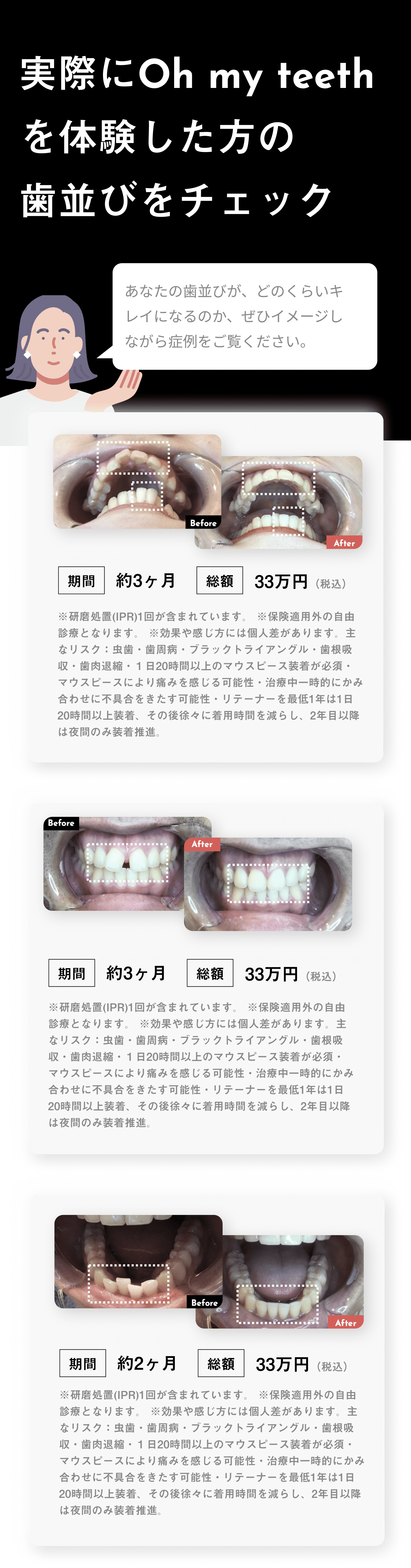 実際に体験した方の歯並びチェック